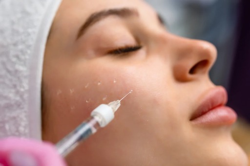 Polynucleotides in Skincare: What the “Salmon DNA Facial” Actually Does
